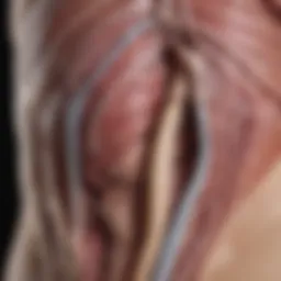 Illustration showing the anatomy affected by congenital diaphragmatic hernia