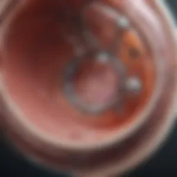 Diagram illustrating the mechanism of action of bladder implants