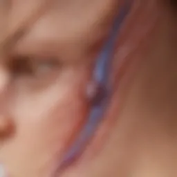 Illustration of the skin layers affected by hidradenitis suppurativa