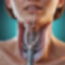 Illustration showing the delivery of chemotherapy agents into the peritoneal cavity.