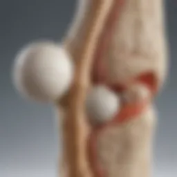 Illustration depicting the structure of a healthy joint compared to an osteoarthritic joint.