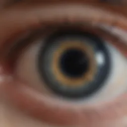 Visualization of corneal structure in keratoconus