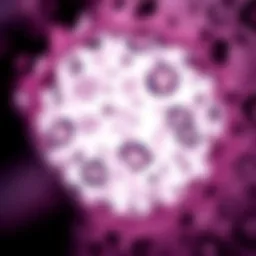 Microscopic view of Invasive Lobular Carcinoma cells