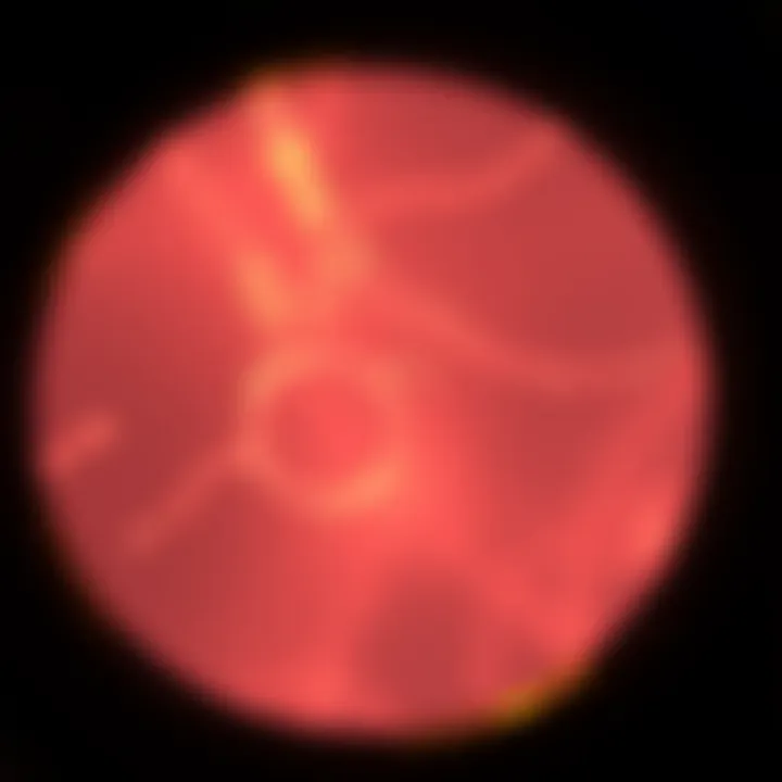 Illustration of Gardnerella species under a microscope