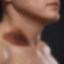 Illustration of melanoma progression