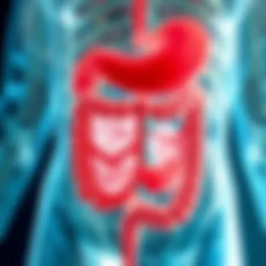 Diagram illustrating the pathophysiology of GI mastocytosis