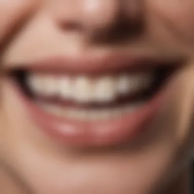 Teeth Before Whitening Treatment Close-up view of teeth with stains before using whitening toothpaste