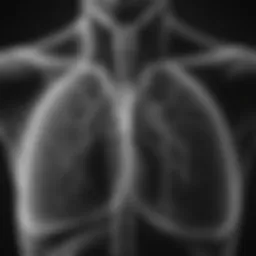 X-ray of lungs demonstrating pneumonia